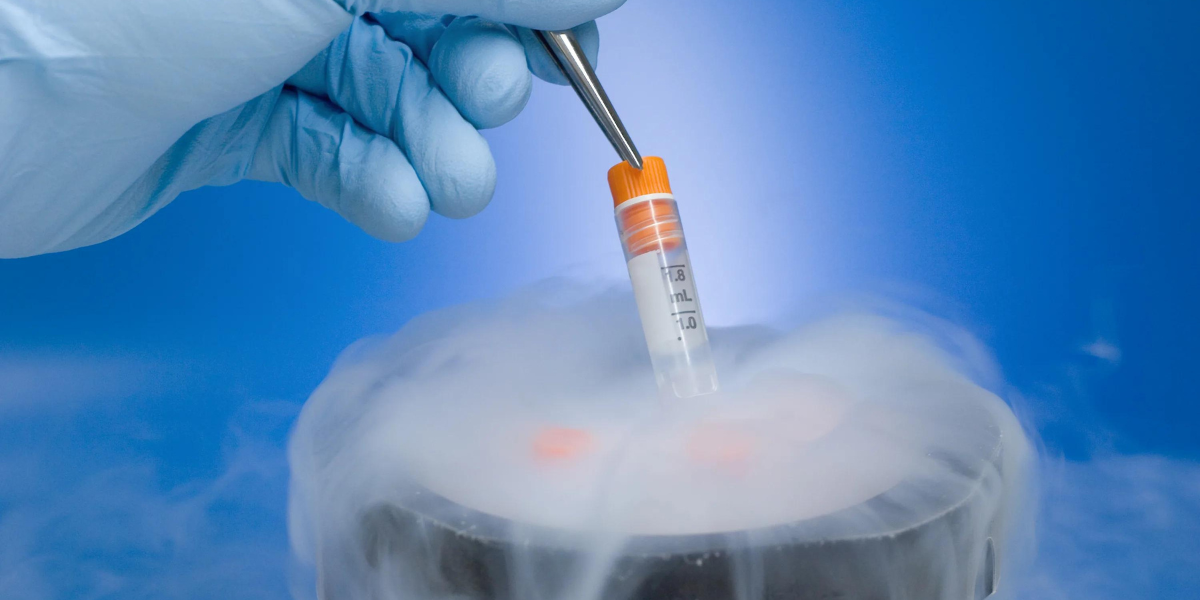 Cryopreservation Servicein Navi Mumbai by Dr. Priya Khamatkar