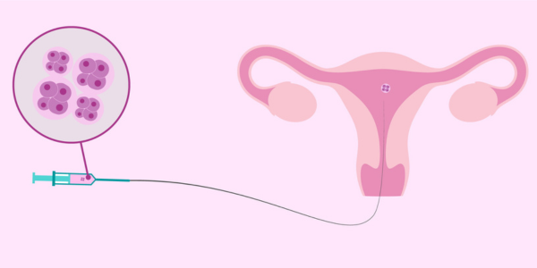 Embryo Donation