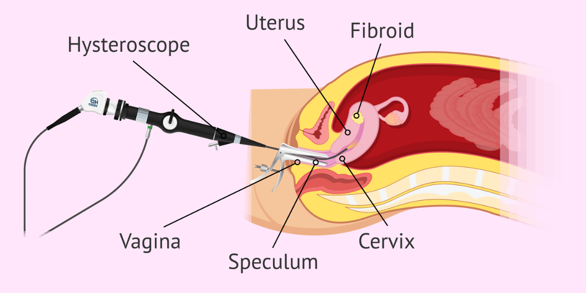 Hysteroscopy and Laparoscopy in Navi Mumbai by Dr. Priya Khamatkar