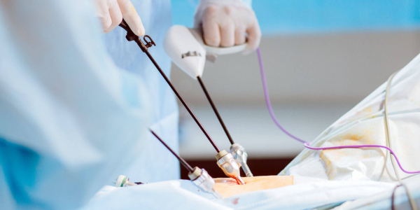 Laparoscopy Surgery in Navi Mumbai by dr. Priya Khamatkar