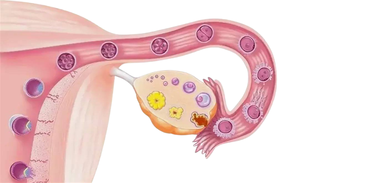 Ovulation Induction in Navi Mumbai by Dr. Priya Khamatkar