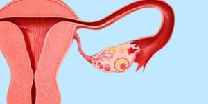 Ovulation Induction Icon