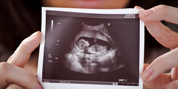 Real-time Imaging procedure